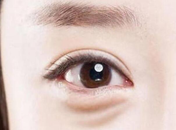眼袋？淚溝？臥蠶？南寧美容學校教你辨別